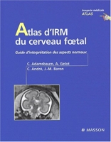 Atlas d IRM du cerveau f tal - Guide d'interprétation des aspects normaux